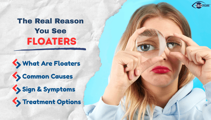 What Causes Floaters and Can They Be Treated?