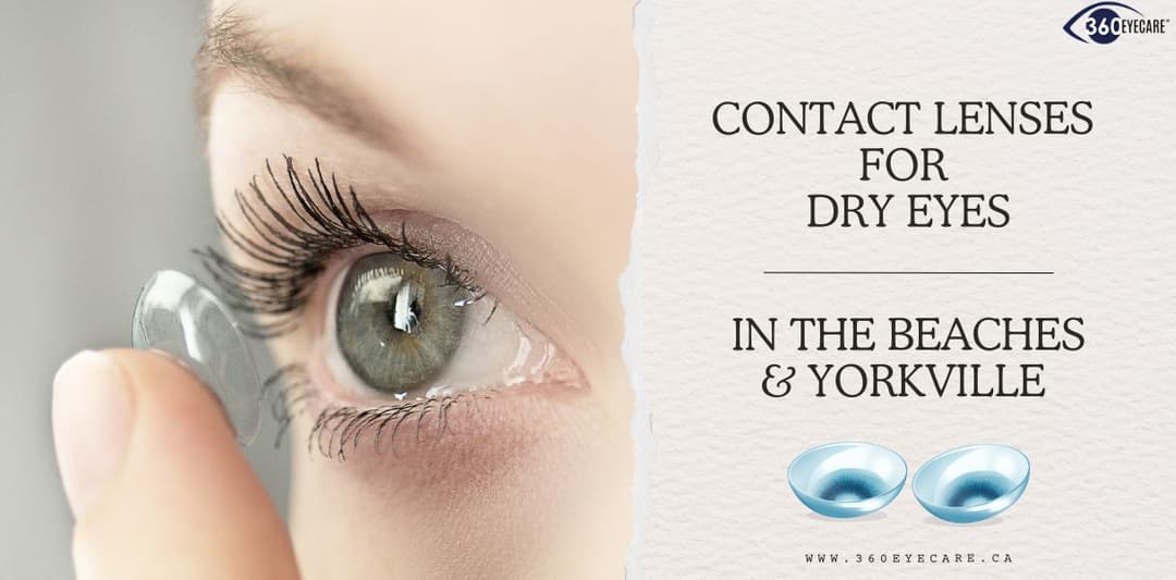 Contact Lenses for Dry Eyes: A Solution for The Beaches and Yorkville & Rosedale Residents