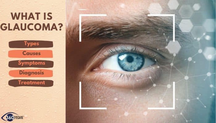 Glaucoma? Causes, Symptoms, and Treatment Options